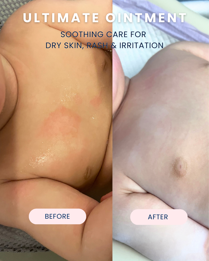 Ultimate Ointment, 3.4 oz