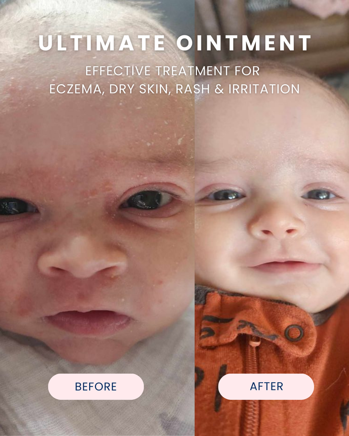 Ultimate Ointment, 3.4 oz